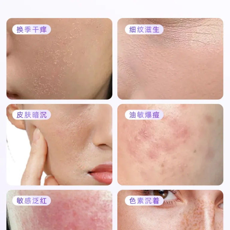 ماسک زیبایی صورت سیلیکونی با نور LED قرمز فرامرزی، دستگاه فوتون ماسک، دستگاه زیبایی صورت نوردرمانی، چراغ بزرگ