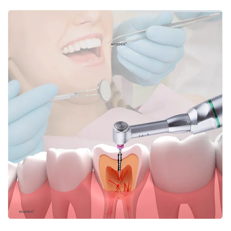 موتور اندو دندانپزشکی با حالت 6، هندپیس LED بی‌سیم، درمان ریشه، جلوگیری از شکستن فایل، دستگاه آماده‌سازی و گشادسازی کانال