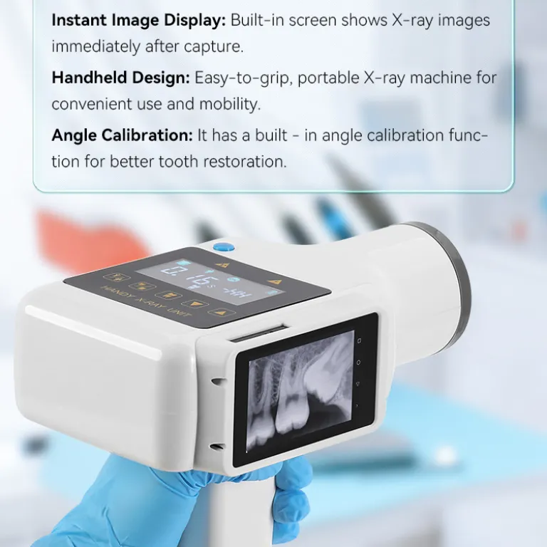 DigitalX-Ray دستگاه رادیوگرافی دندان قابل حمل با سنسور تصویربرداری دیجیتال دهان و دندان