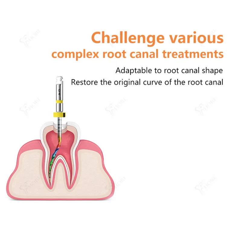 فایل روتاری دندانپزشکی فعال‌شونده با حرارت برای درمان ریشه، بازکننده و گشادکننده کانال DENTAL ROTARY FILES