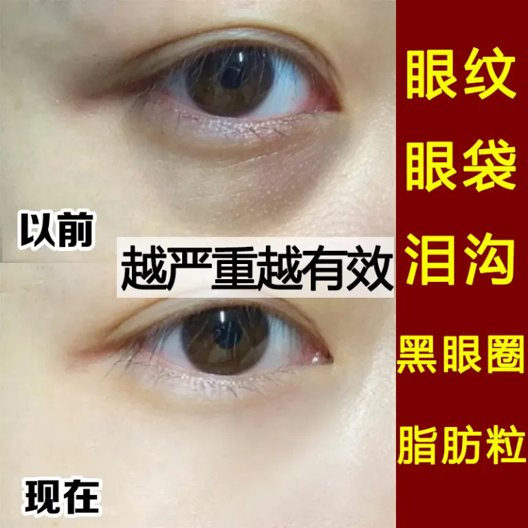 کرم دور چشم سفت‌کننده ضد چروک شماره یک، محوکننده خطوط ریز، تیرگی و چربی زیر چشم، کرم دور چشم اصل ضد چروک، رفع پف و سیاهی دور چشم