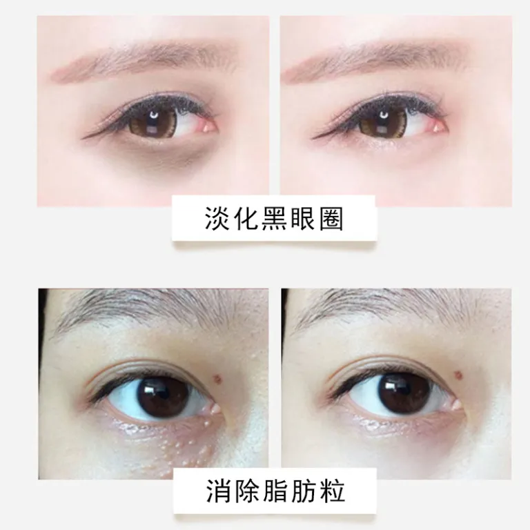 کرم دور چشم سفت‌کننده ضد چروک شماره یک، محوکننده خطوط ریز، تیرگی و چربی زیر چشم، کرم دور چشم اصل ضد چروک، رفع پف و سیاهی دور چشم